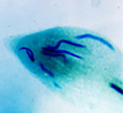 Clover root nematode